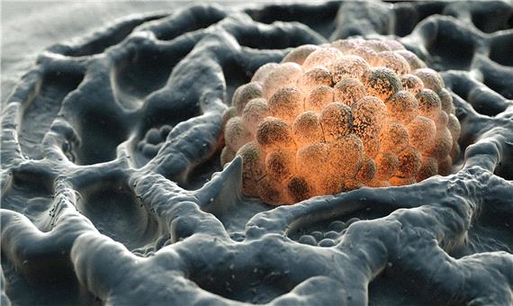 بررسی دقیق فرایند متاستاز سلول‌های سرطانی