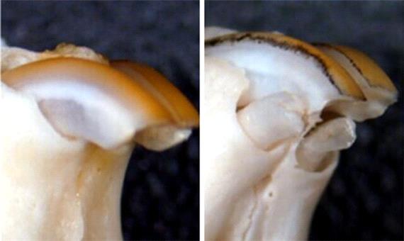 آیا رشد مجدد دندان‌های دائمی امکان پذیر است؟