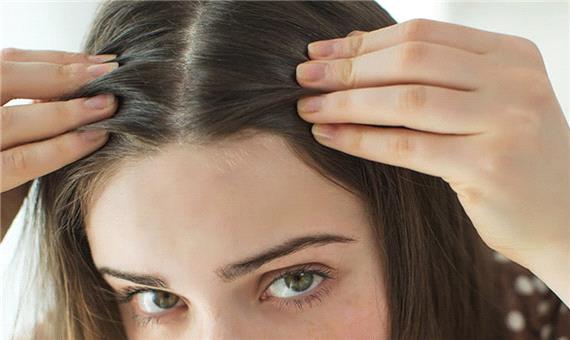 درمان سفیدی و ریزش مو با چند ترفند ساده در منزل