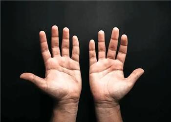 چرا پنج تا انگشت شبیه هم نیستند؟