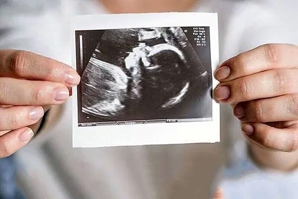 زنان تا چه سنی می‌توانند صاحب فرزند شوند؟