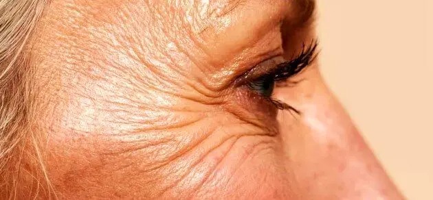 چگونه با افزایش سن از «پروتئین نگهدارنده بدن» مراقبت کنیم؟