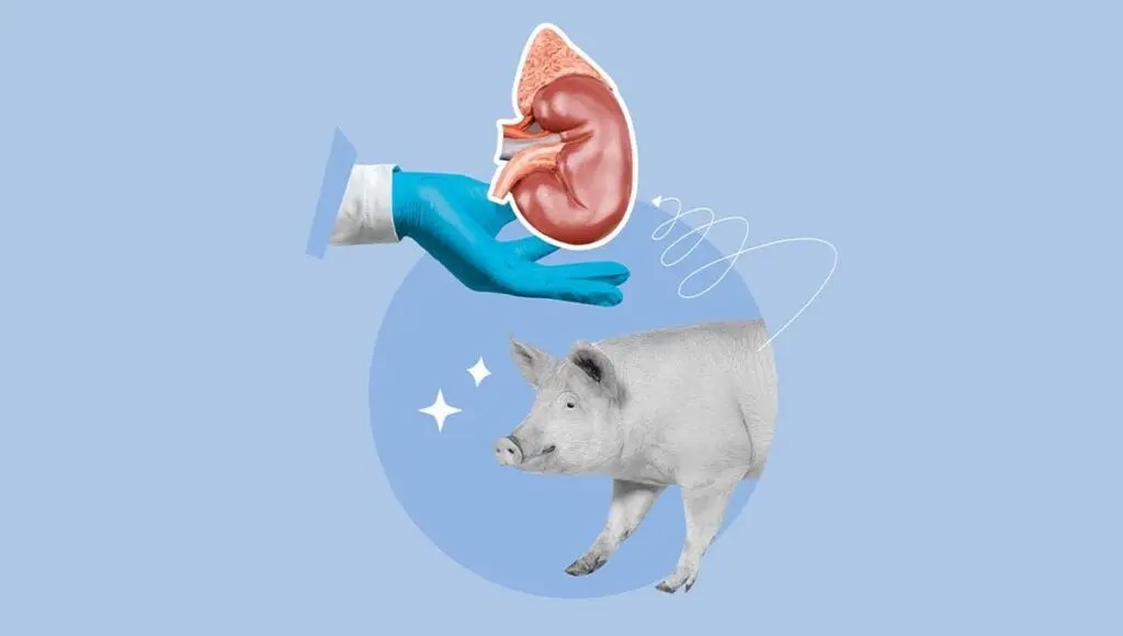 احیا کلیه های منجمد خوک بعد از یک سال